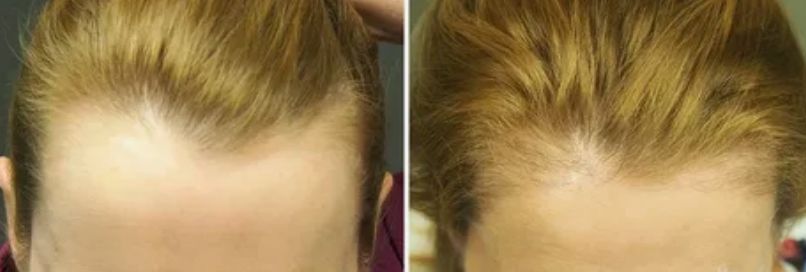 Before & After